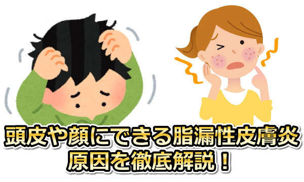 脂漏性皮膚炎の原因